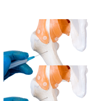 Bone Cancer Specialist