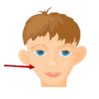 Cheek