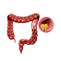 Colon Specialist