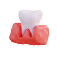 Gums