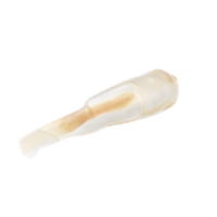 Trachea
